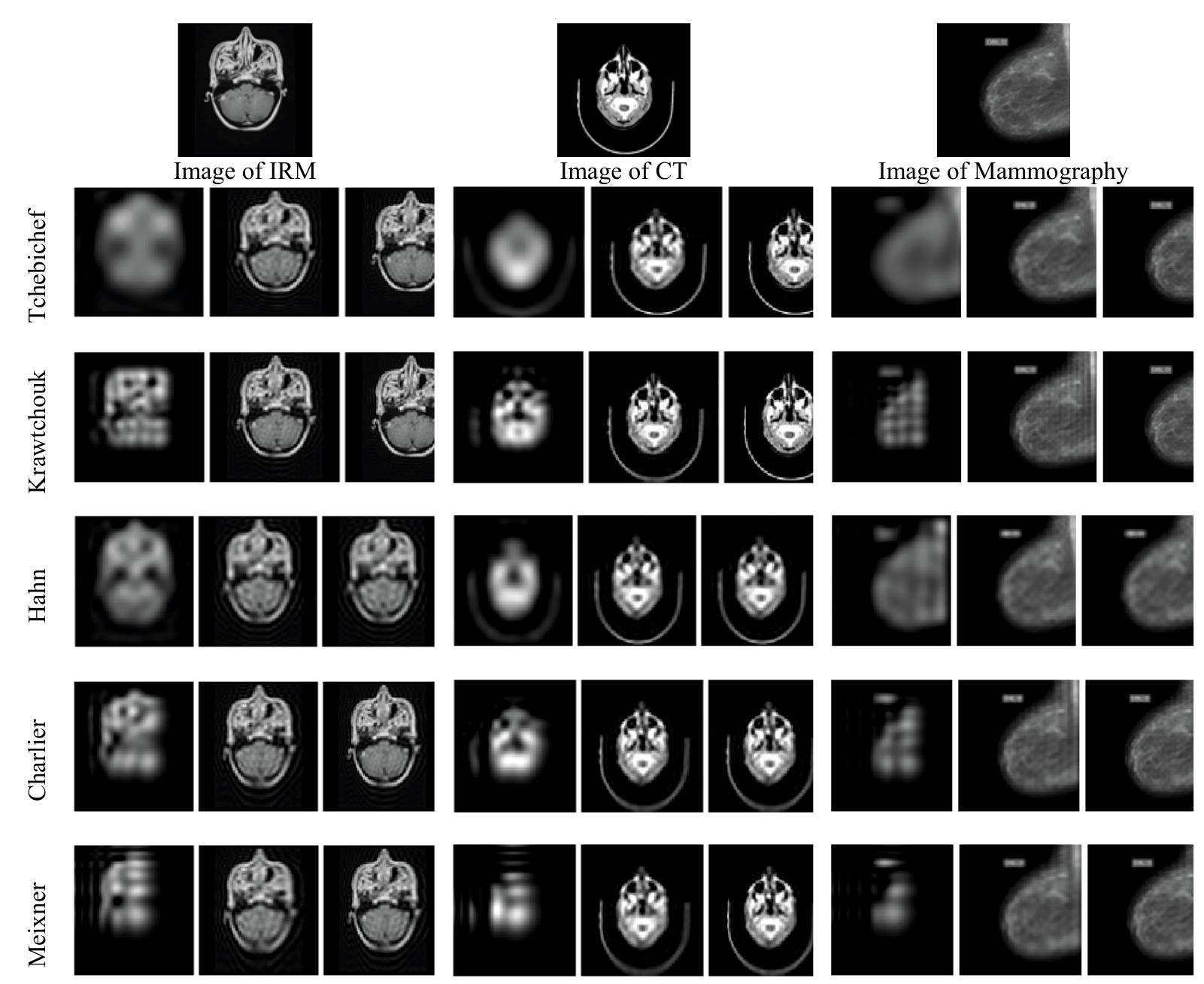 Figure 1 - from 2D and 3D Medical Image Analysis by Discrete