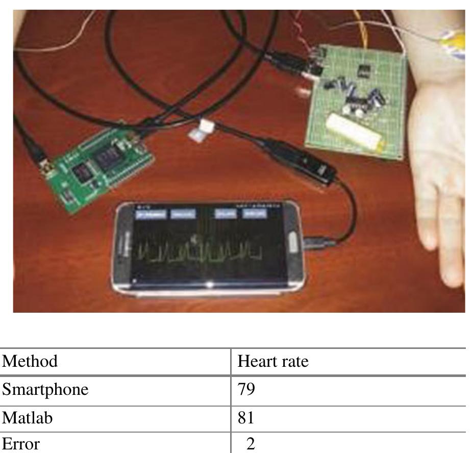 (PDF) Design and Implementation of a Wearable Real-Time ECG Monitoring ...