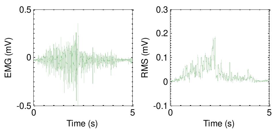 Moving Rms Signal Figure 2 - from EMG Based Control of a Robotic Exoskeleton