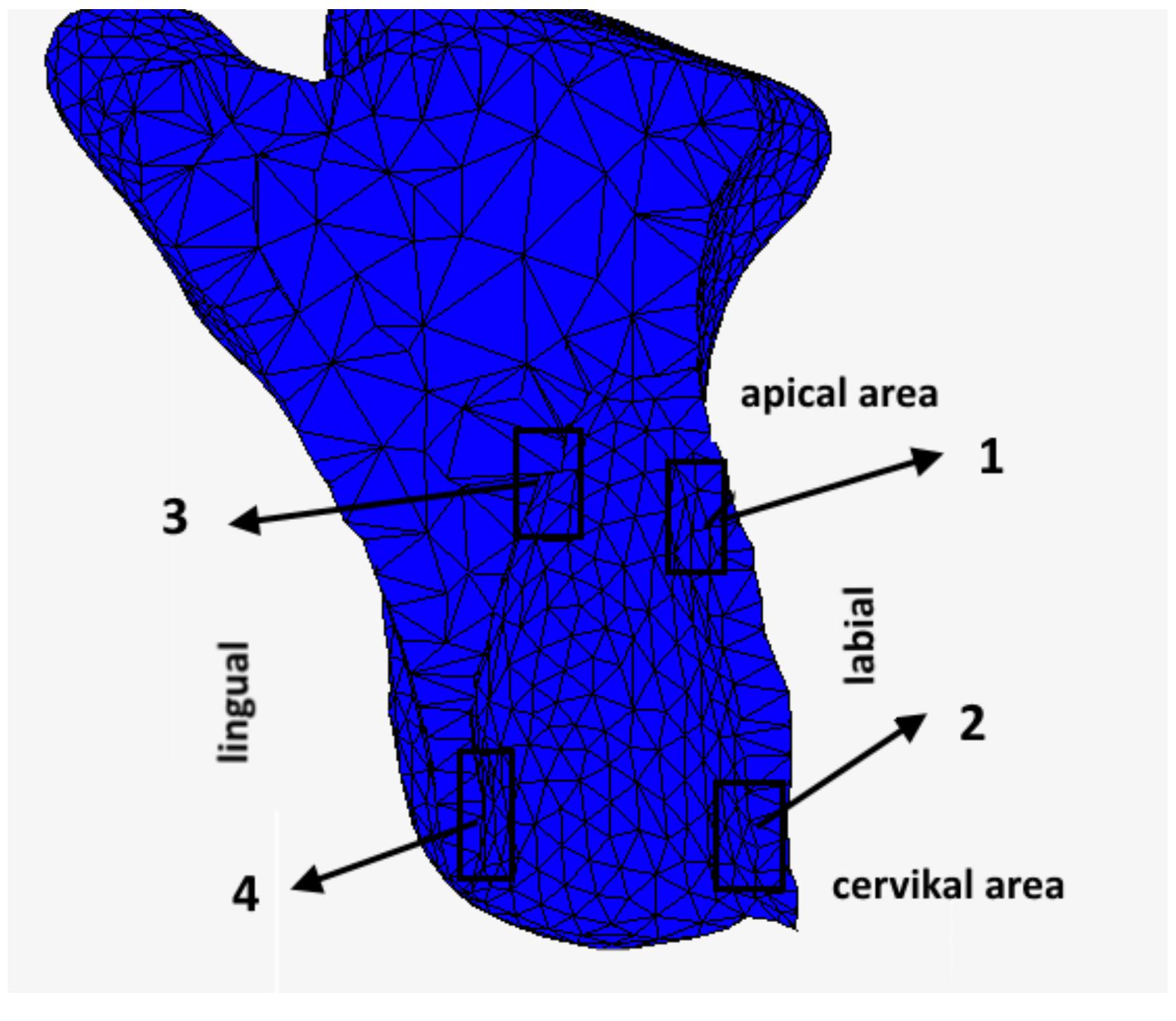 (PDF) Modelling of initiation of bone remodelling due to orthodontic ...
