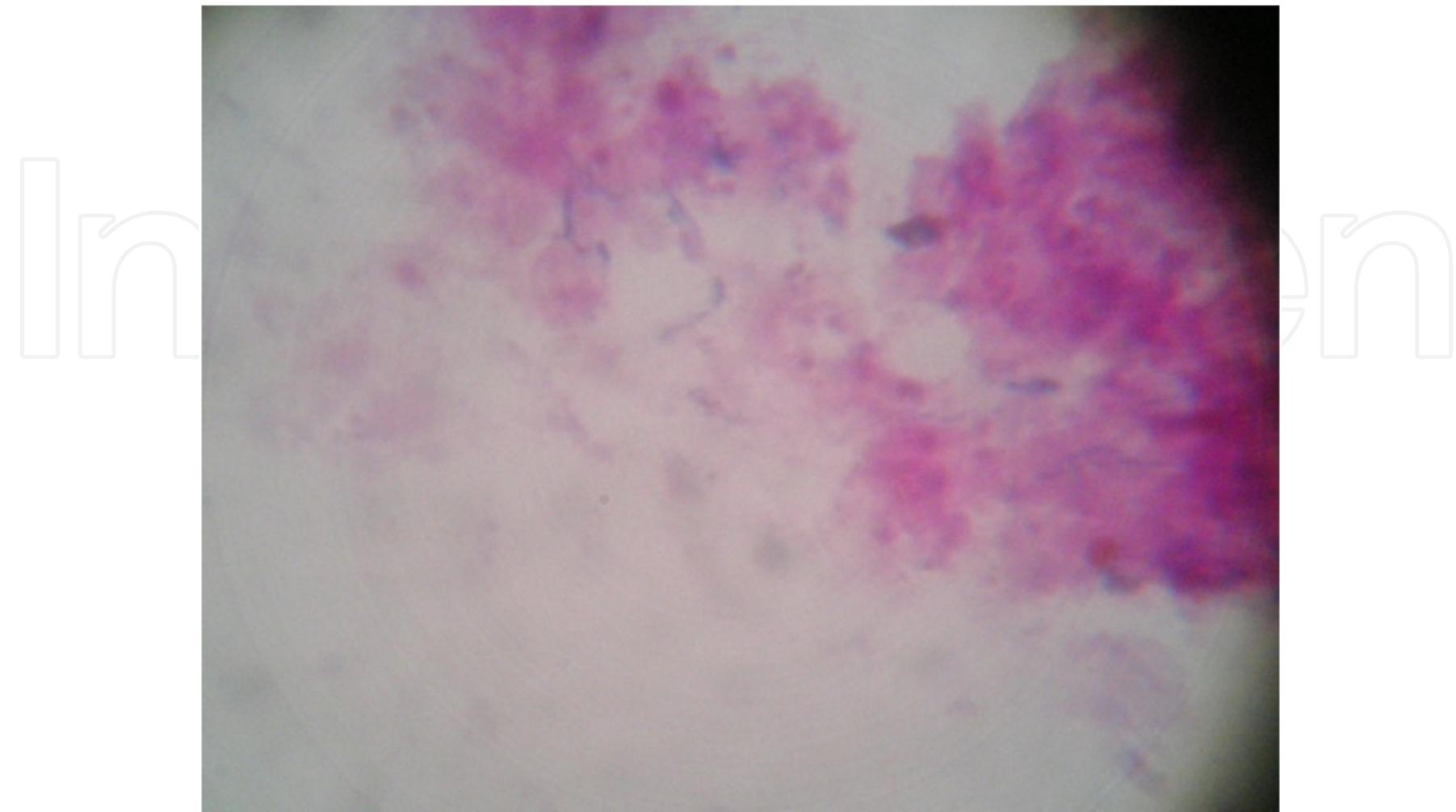 Figure 1 - from Nocardiosis: Clinical and Pathological
