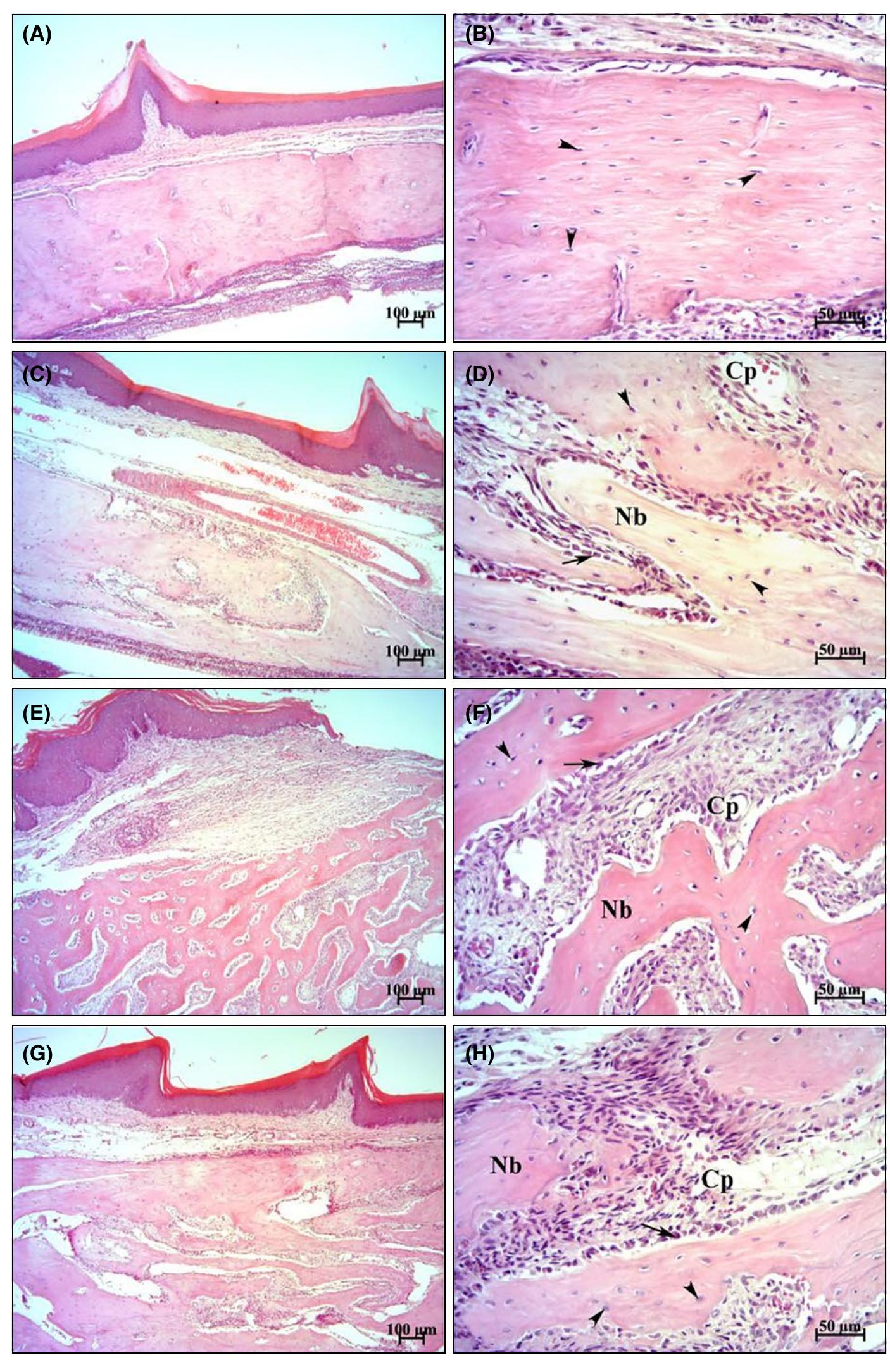 Figure 2 - Effects of curcumin and melatonin on bone