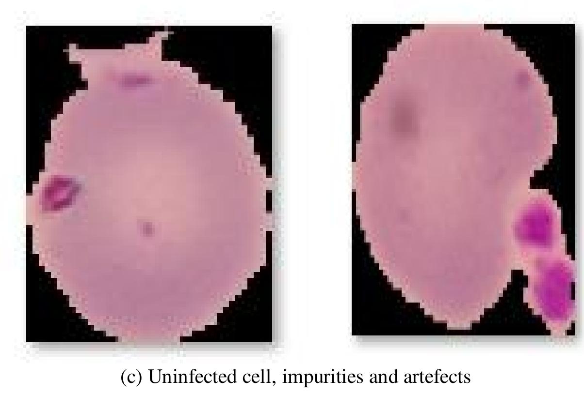 (PDF) Malaria Parasite Detection using Deep Learning