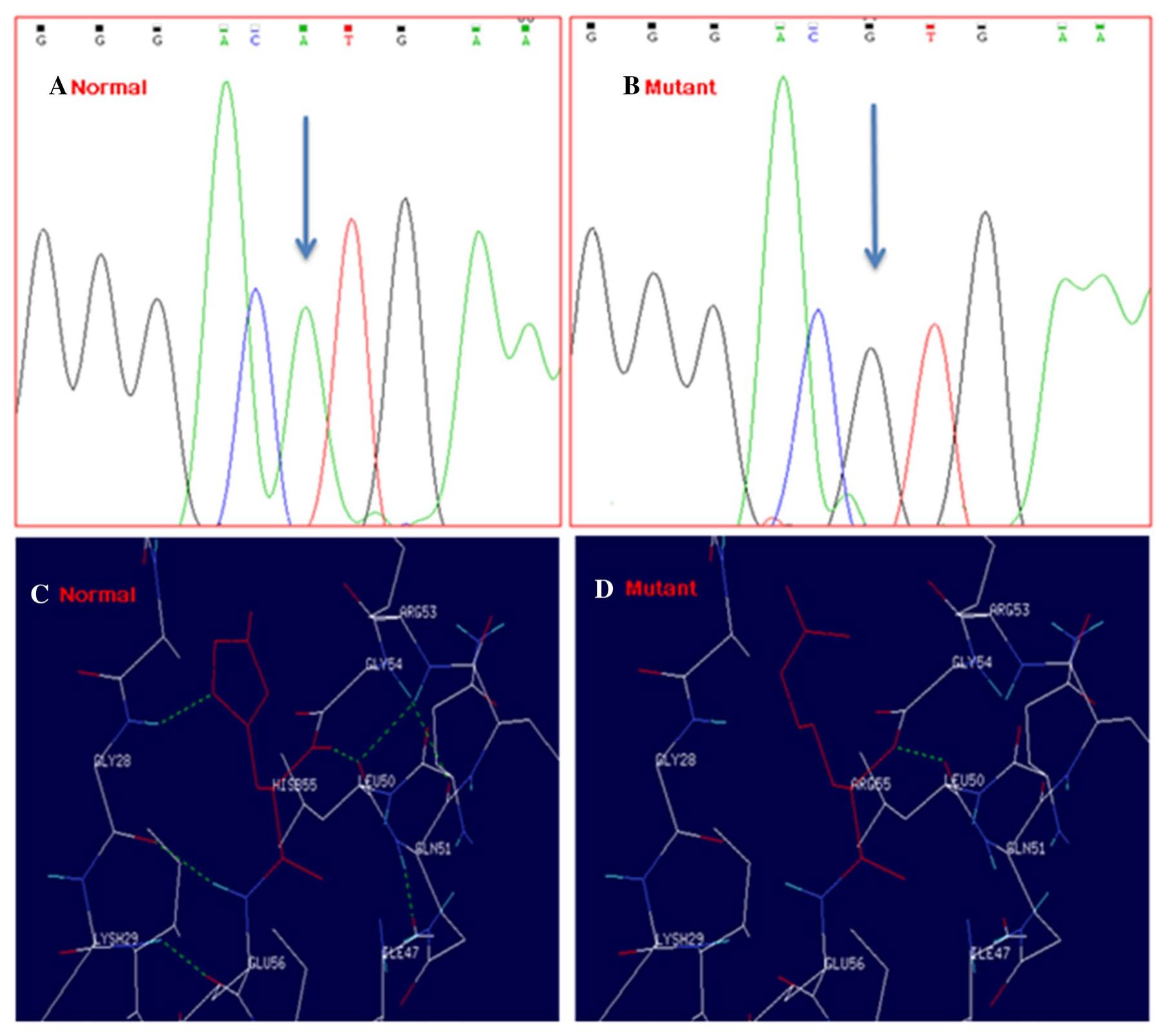 (PDF) Genetic lesions in the UGT1A1 genes among Gilbert’s syndrome ...