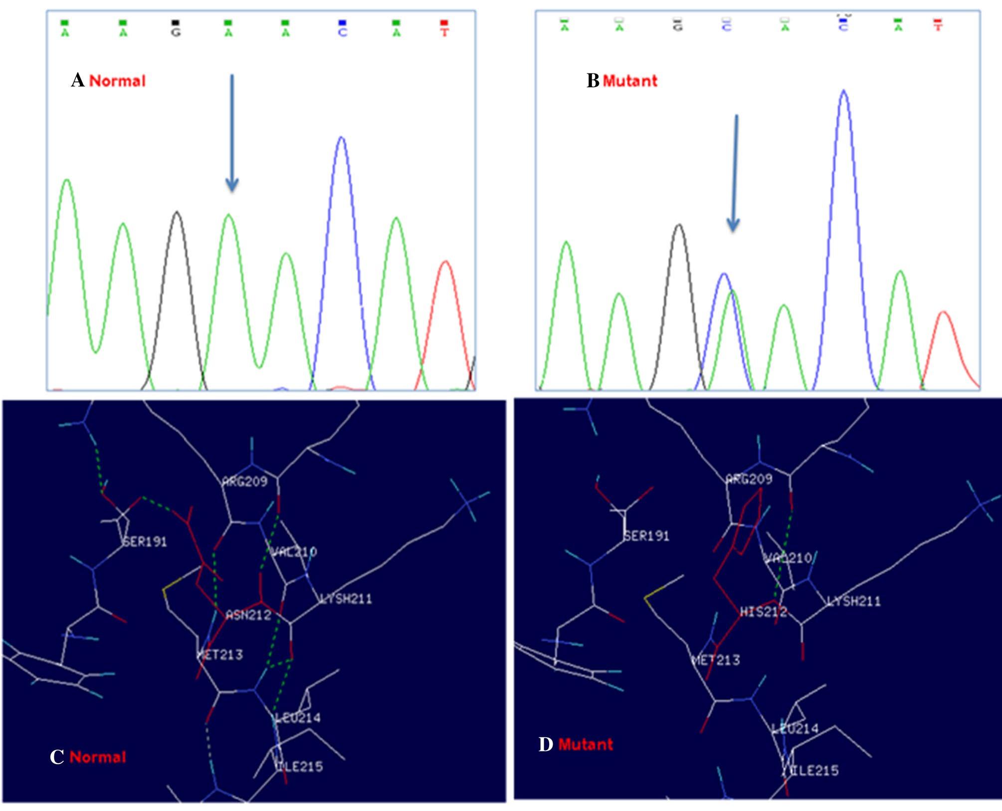 (PDF) Genetic lesions in the UGT1A1 genes among Gilbert’s syndrome ...