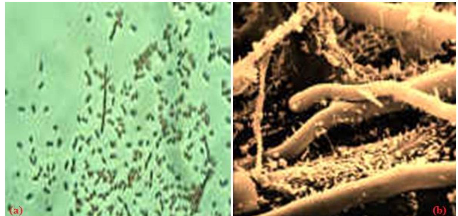 Figure 2. Microscopic representation of bacteria biodiversity in soil environment: (a) a ton of microscopic bacteria may be active in each acre of soil and (b) Bacteria dot the surface of strands of fungal hyphae [The images were used by the authors with the copyright permission of Soil and Water Conservation Society]  Soil organisms provide many supports in the trasformation and development of soil physical and biological properties. They are exclusively part of soil formation and decomposition processes of diverse plant and animal materials (Janney, 1994). Bacteria contribute to the carbon cycle by fixation (photosynthesis) and decomposition of organic materials and hence might improve soil colour and soil quality (Darbyshire, 1994; FAO, 2005). Their activities might also help to improve the strength of soil particles and soil resilience against soil runoff and soil erosion. Fungi also help in binding soil particles and an increase water infiltration and soil water holding capacity (Alfred, 2001; Ritz et al., 2004). Generally, a ton of microscopic bacteria may be active in each acre of soil as typically indicated in Figure 2 (NRCS: www.nrcs.usda.gov720 x 475 Search by image). These active organisms fall into four functional groups - decomposers, mutualists (form partnership with plants - nitrogen-fixing bacteria), pathogens and lithotrophs or chemoautotrophs; both played a vital role in soil nutrient cycling (Coleman et al., 1983; Ingham, 2000). 