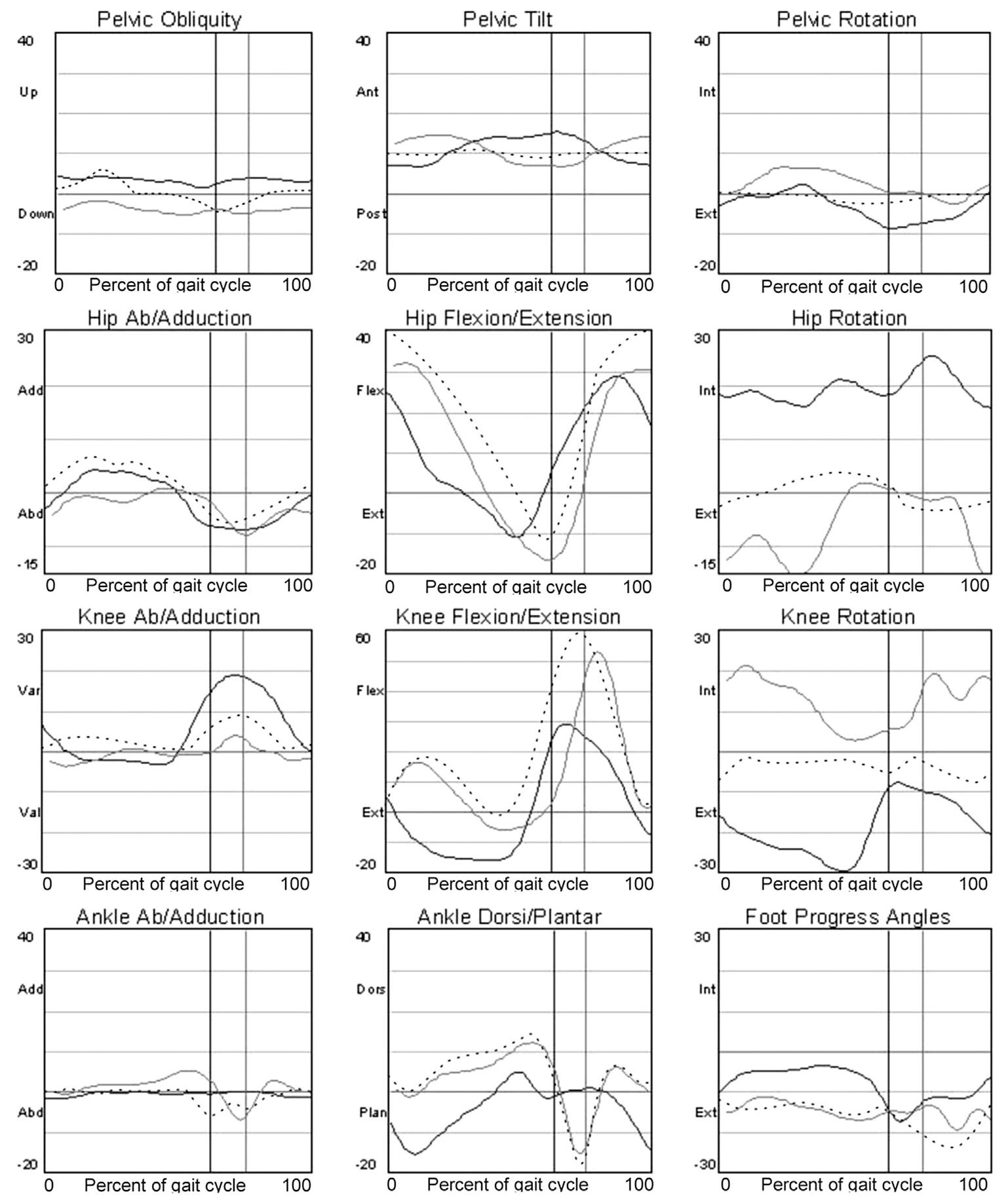 Kinematic graphs of the pelvis, hip, knee, and ankle in 3