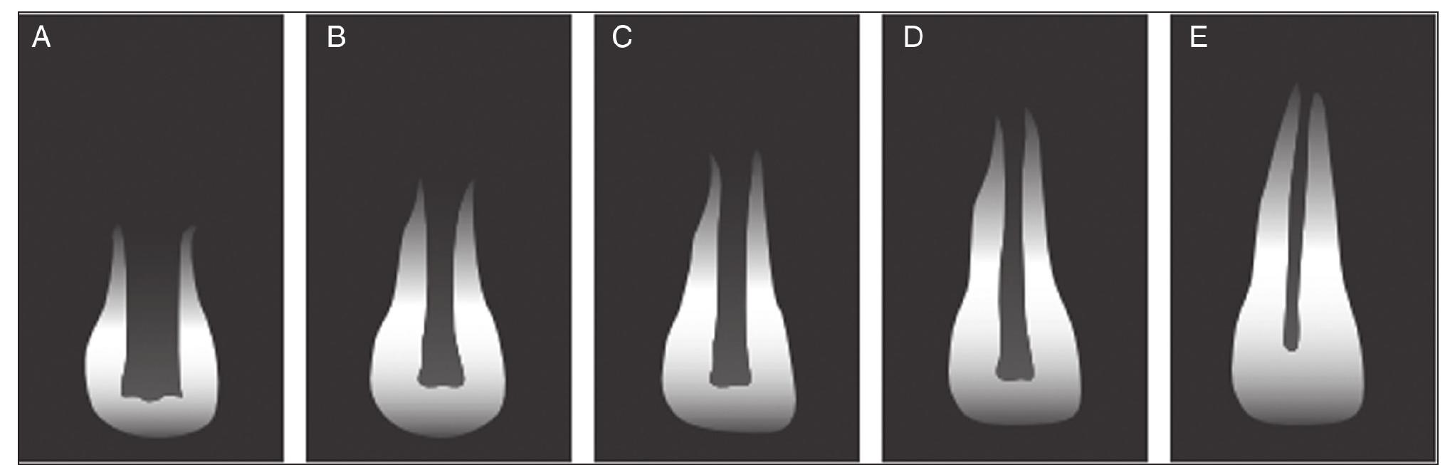 Root Development Blood Stages of root development. a, b, c, d and e indicate stages