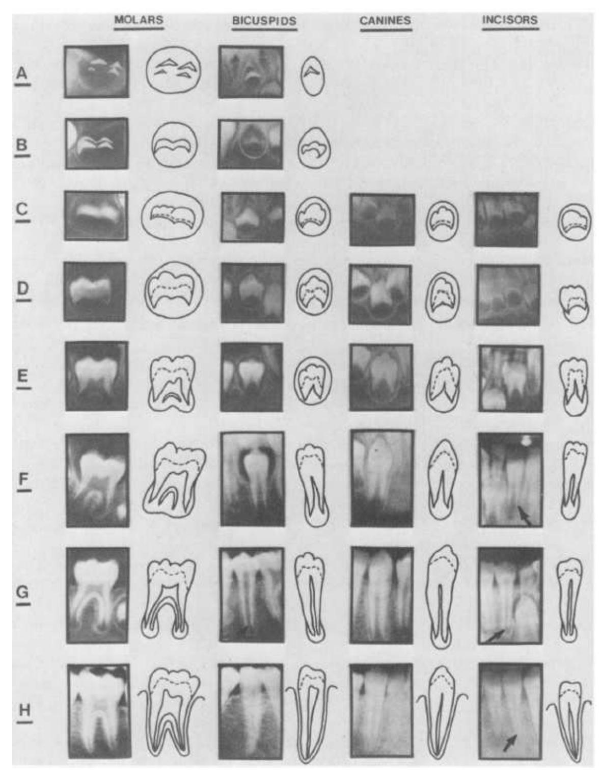 Developmental stages of the permanent dentition [55]. in