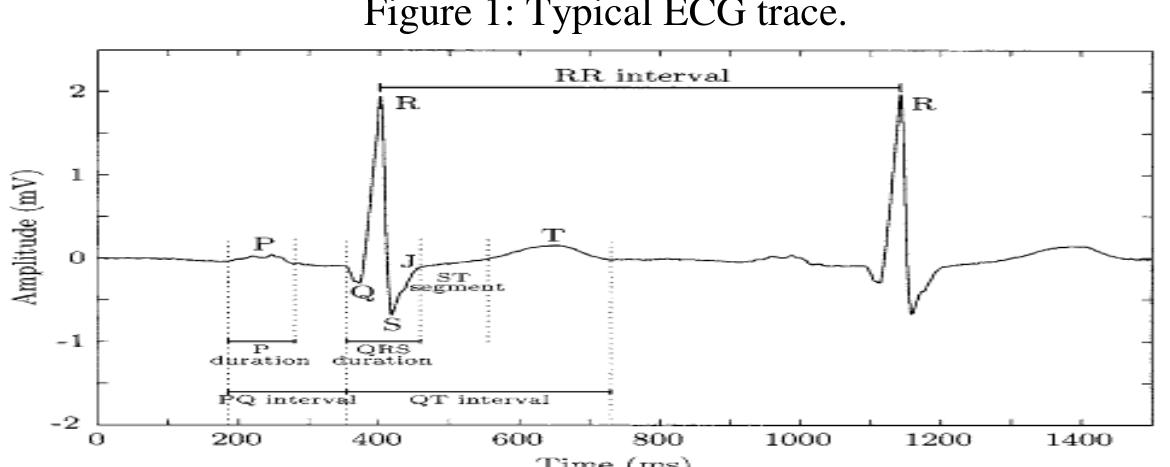 (PDF) Reduction of Power Line Interference in Ecg Signal Using Fir Filter