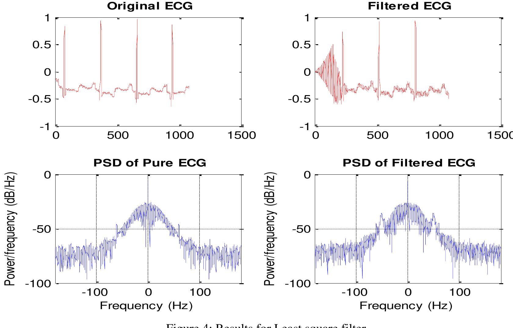 (PDF) Reduction of Power Line Interference in Ecg Signal Using Fir Filter