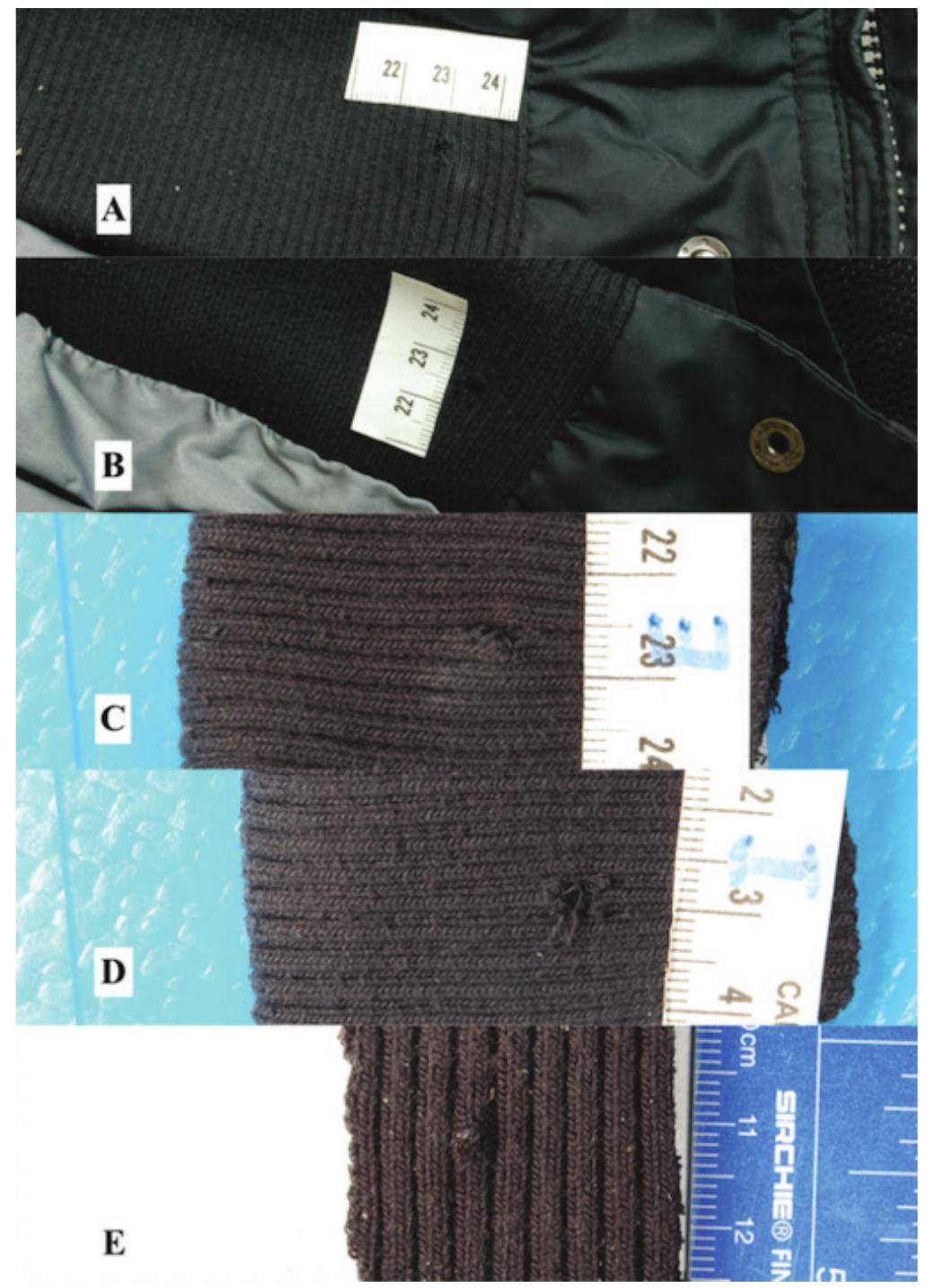 Figure 1. Hole through the elastic fabric of the jacket, front view (A.C), internal view (B, D). Macroscopic aspect of the control sample from a different part of the jacket (E).  The first step of the study was represented by an examination using a stereo zoom photo microscope. Then, the portion of fabric surrounding the hole has been cut and observed using a FEI, Quanta 400TM SEM microscope. As a case control, a sample of fabric from the same jacket from a not injured area was employed Fig. 1 E). The procedure was carried out in 3 steps: 1) sampling of a portion of the fabric taken from a part of the jacket near the hole examined; 2) shooting test on  