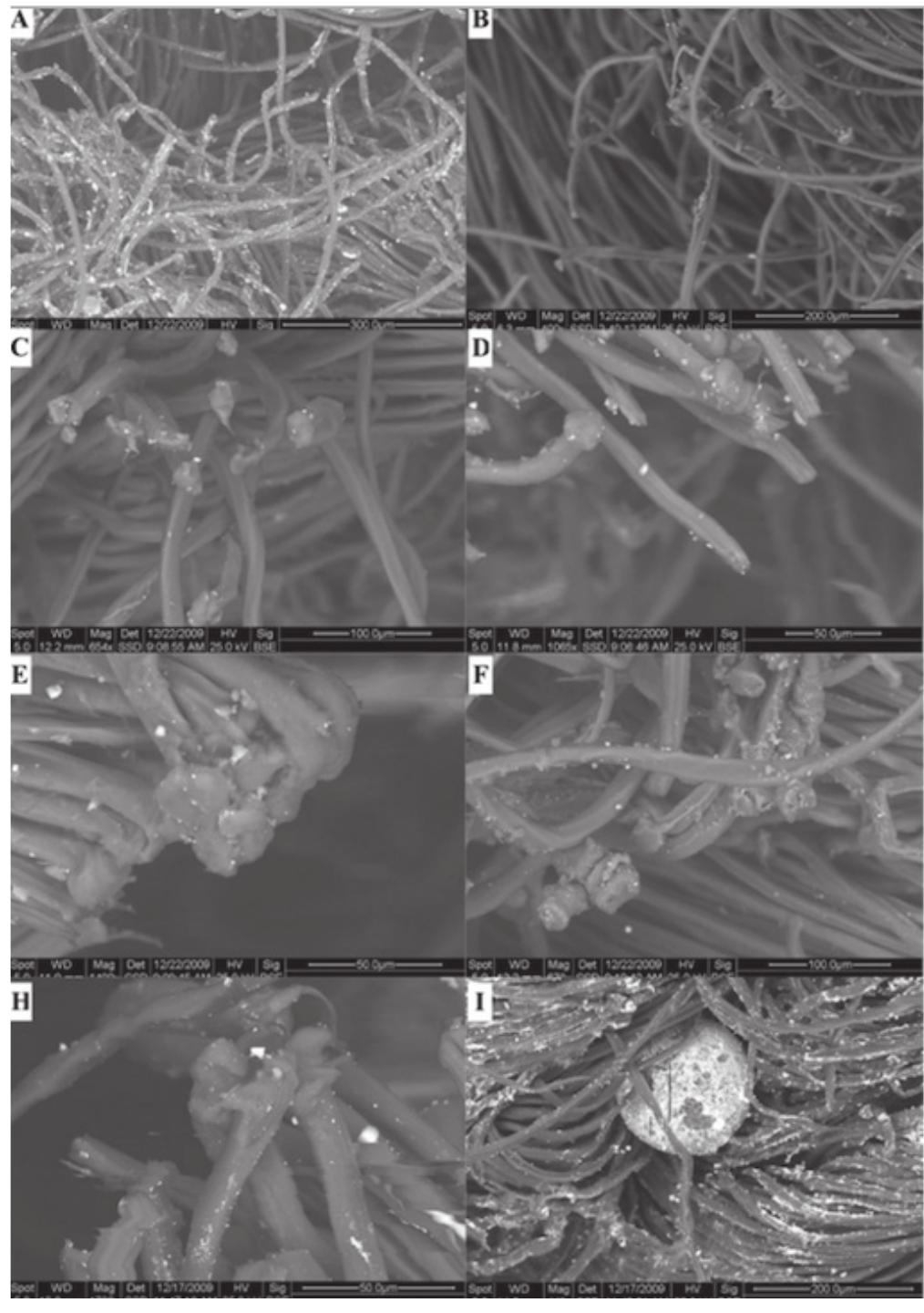 Figure 2. Case control, different features of the textile fibers around the hole A) curled fibers; BCD) dam-aged fibers; E) fibers joined together; F) Fibers fused; G) GSR in the textile fabric.  Clothing damage analysis is an important tool for forensic investigations and, even it is a niche field, it is gaining interest [1]. Moreover, the attention is shifting 