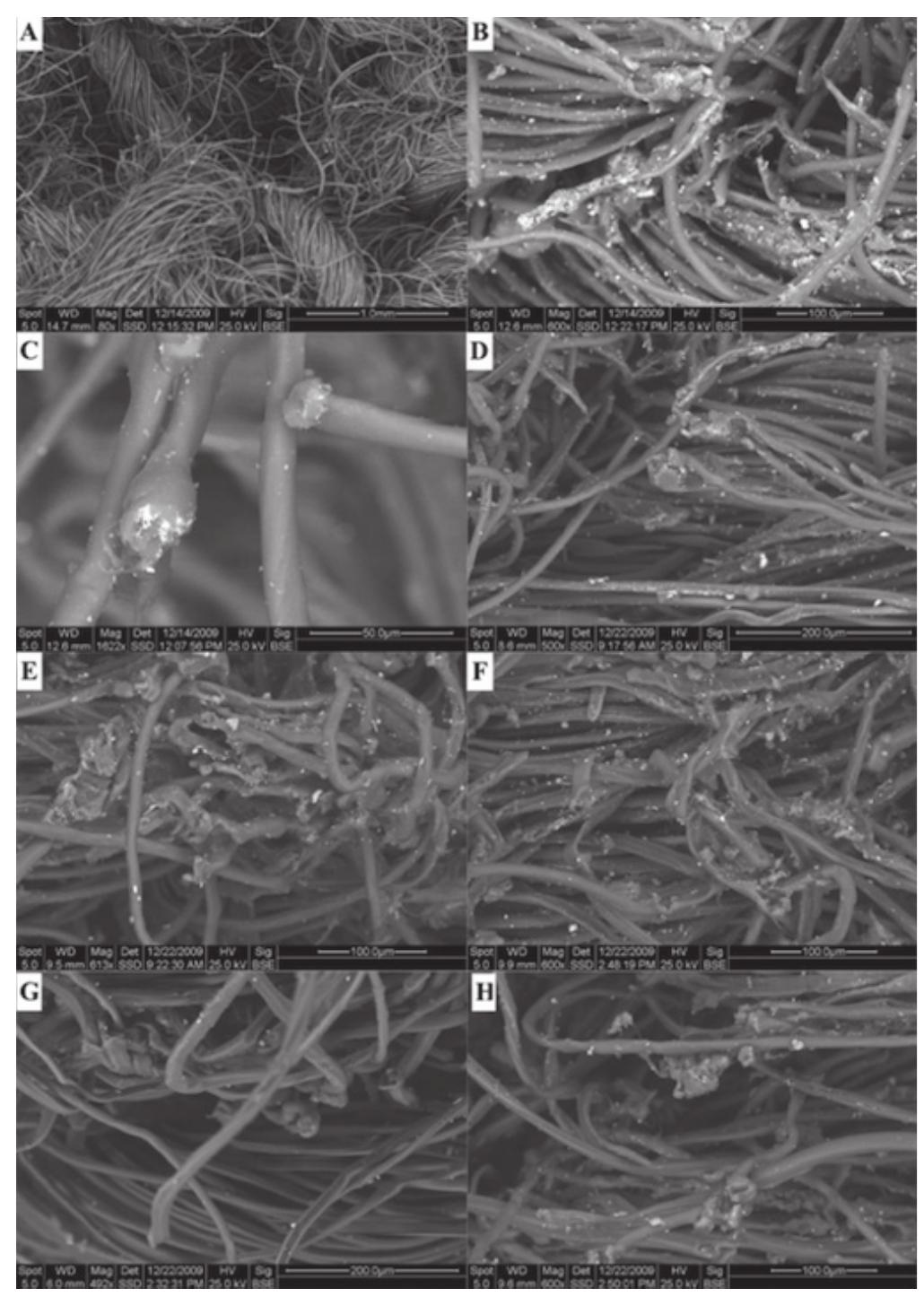 trom evaluating just the biological traces tound or the clothes to the modifications that clothes themselve: undergo in the context of a specific traumatic dynamic Most of the published studies about clothing damag mainly focused on damages produced by sharp force 5,6]. Kemp et al. studied the features of textile damage caused during stabbing in order to identify the blade ype and size. They highlighted that blades could be differentiated and directionality estimated by observing differences in severance shape and size, the degree o fabric distortion, the position of severed yarn ends, loo snippets, curled yarns, planar array and the morpholog} of fractured fibres [6]. Daeid et al. analyzed both the clothing damage and the corresponding skin injury reporting a significant difference between the length of wound on the skin and the above clothing damage wher it was stretched over the skin, on the contrary, there wa: not a statistically significant difference when the fabri: was loose over the skin [5]. Blunt trauma can determine three types of clothing damage: (1) fiber/yarn flattening (2) fiber fracture and (3) holes [7]. Daroux et al. studiec the effect of laundering on blunt force impact damags in fabrics reporting that laundering after the impac   Figure 3. Evidence, different features of the textile fibers around the hole. 
