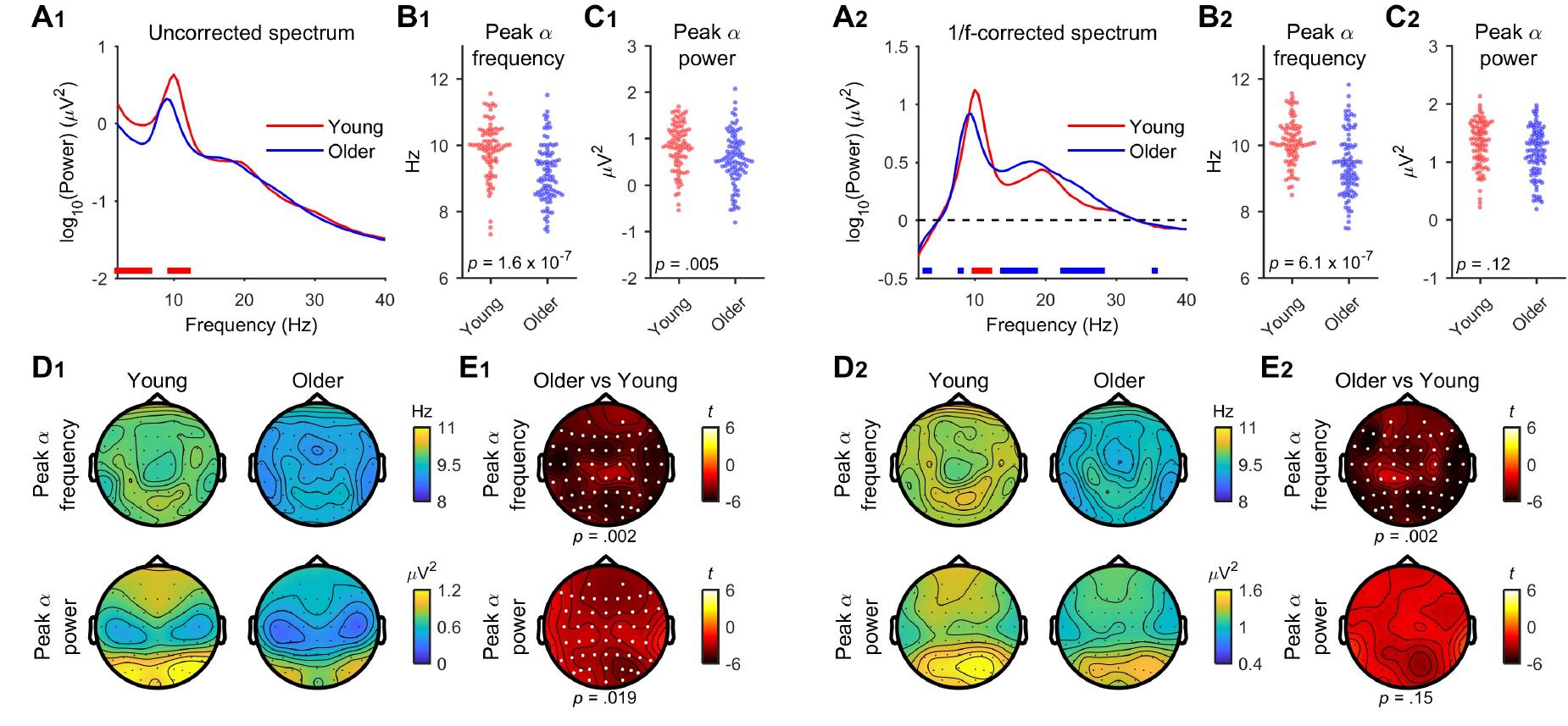 (PDF) Age differences in aperiodic neural activity measured with ...