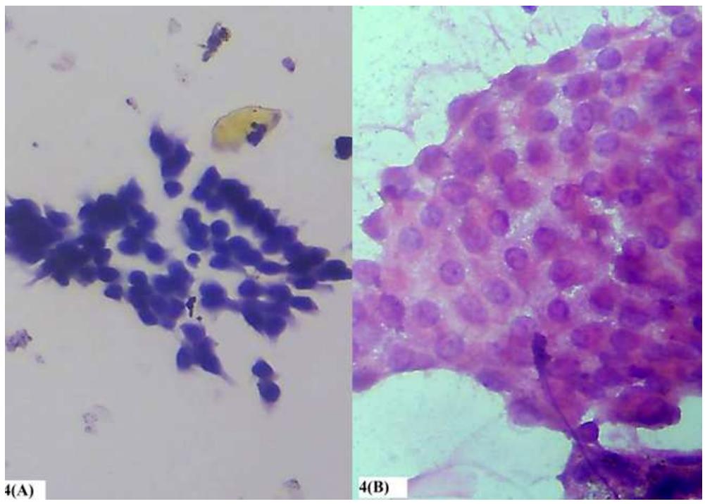 Cytorich (PDF) Cytorich fixative system- A new modality in haemorrhagic fine ...