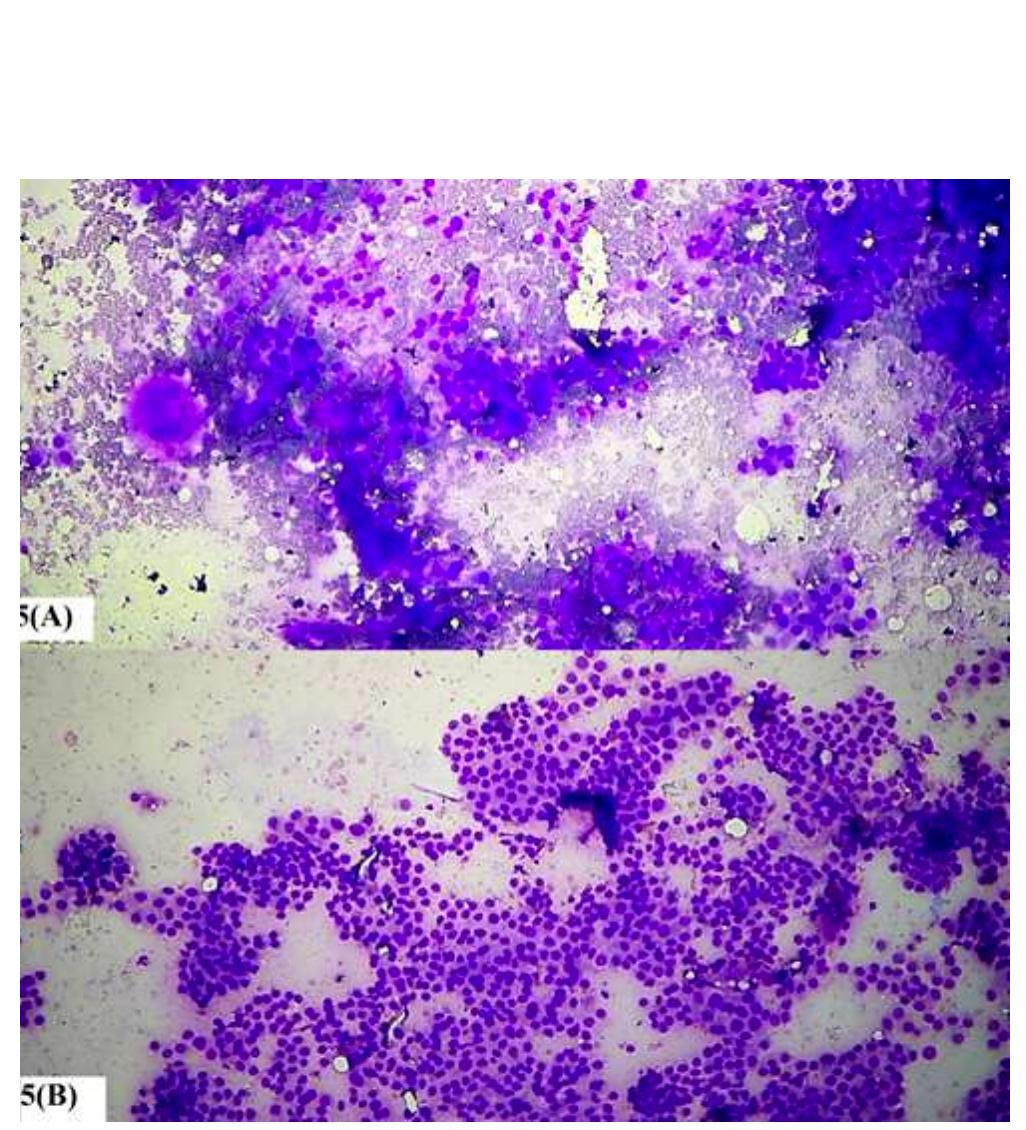 Cytorich (PDF) Cytorich fixative system- A new modality in haemorrhagic fine ...