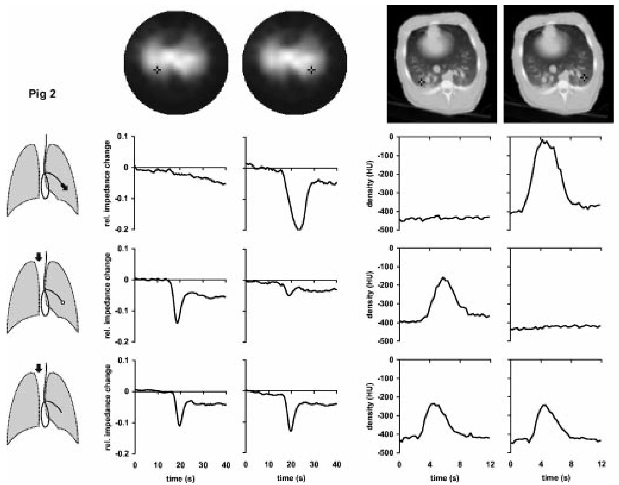 (PDF) Regional lung perfusion as determined by electrical impedance ...