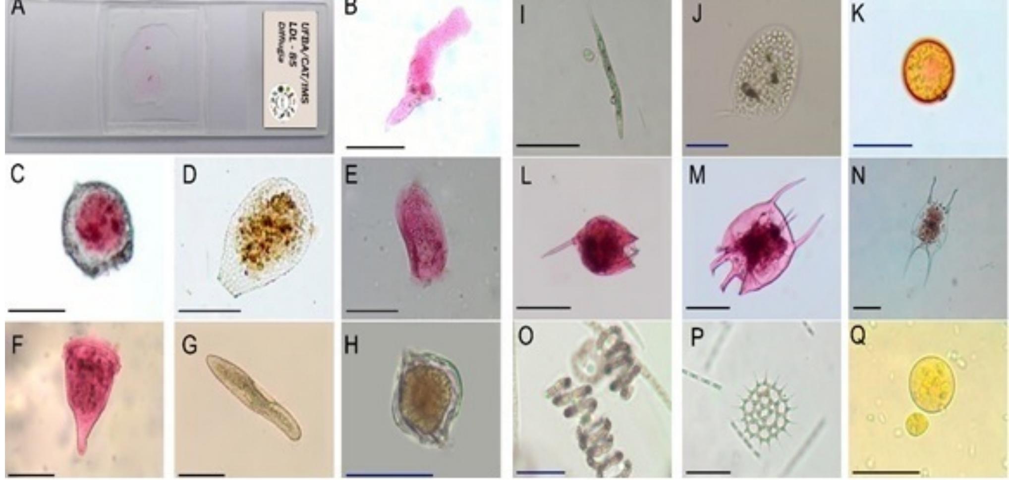 (PDF) Glycerin-Jelly as medium mounting permanent slides of protists ...