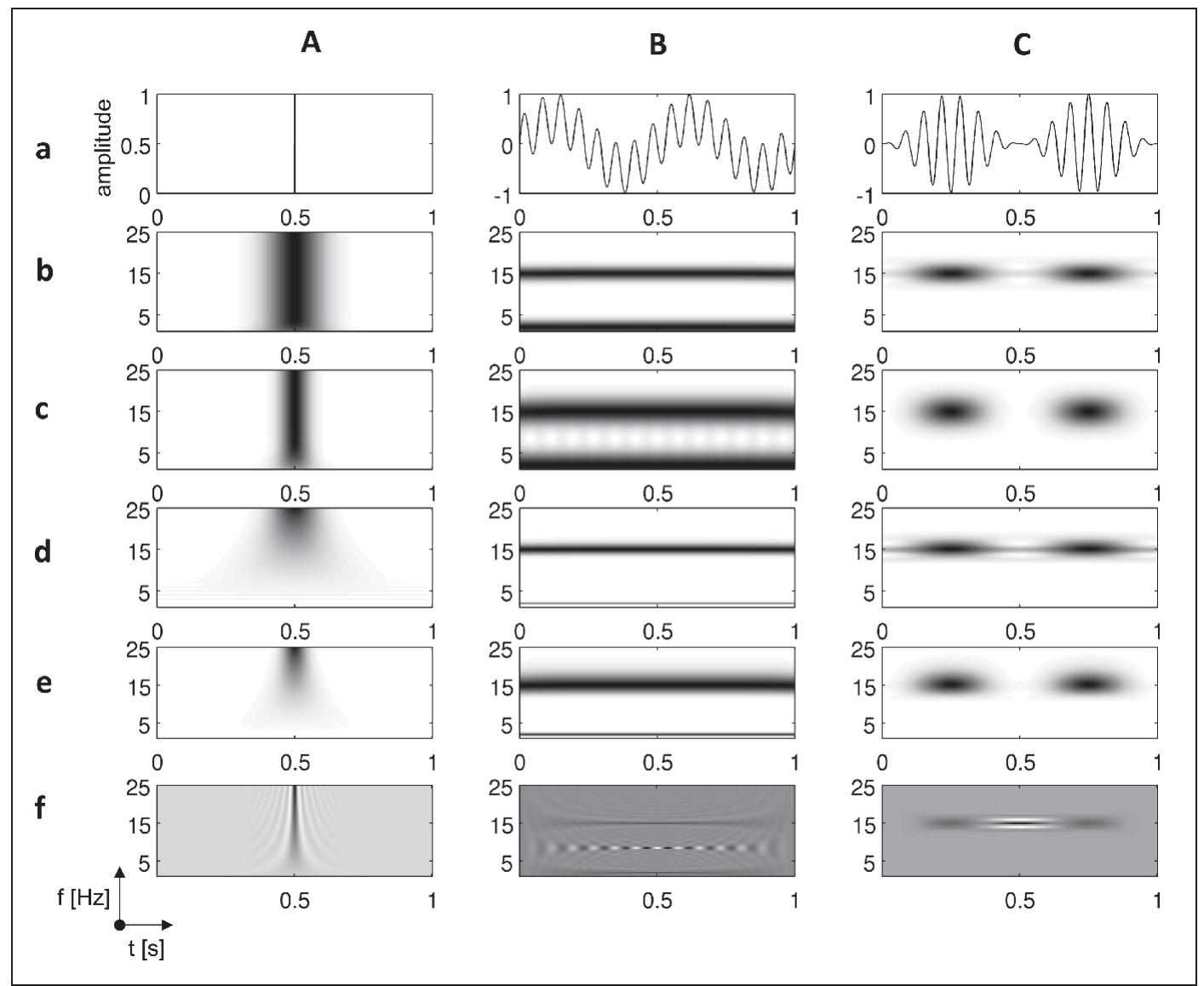 (PDF) Time-frequency Techniques in Biomedical Signal Analysis