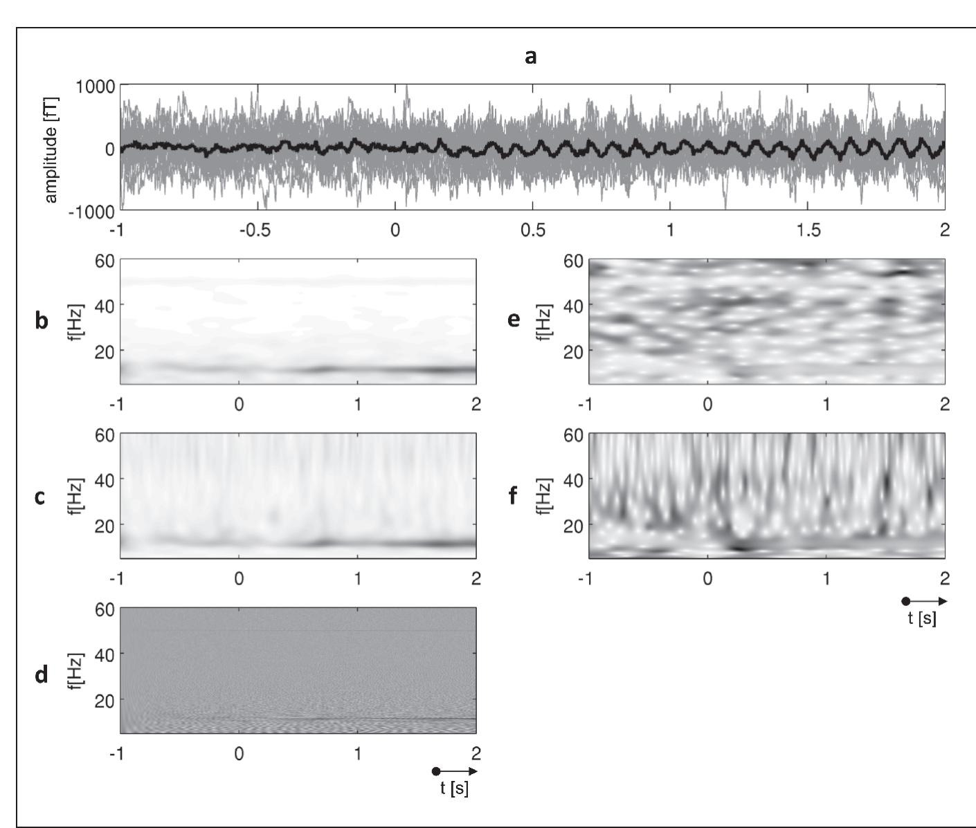 Scalogram Spectrogram (PDF) Time-frequency Techniques in Biomedical Signal Analysis