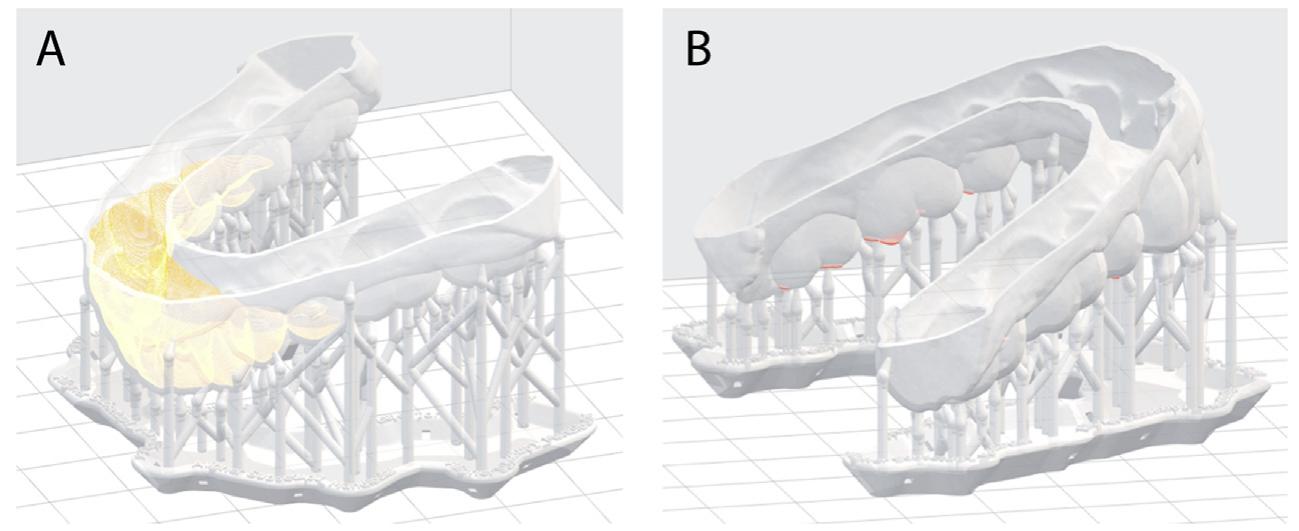 (PDF) Mechanical and geometric properties of thermoformed and 3D ...
