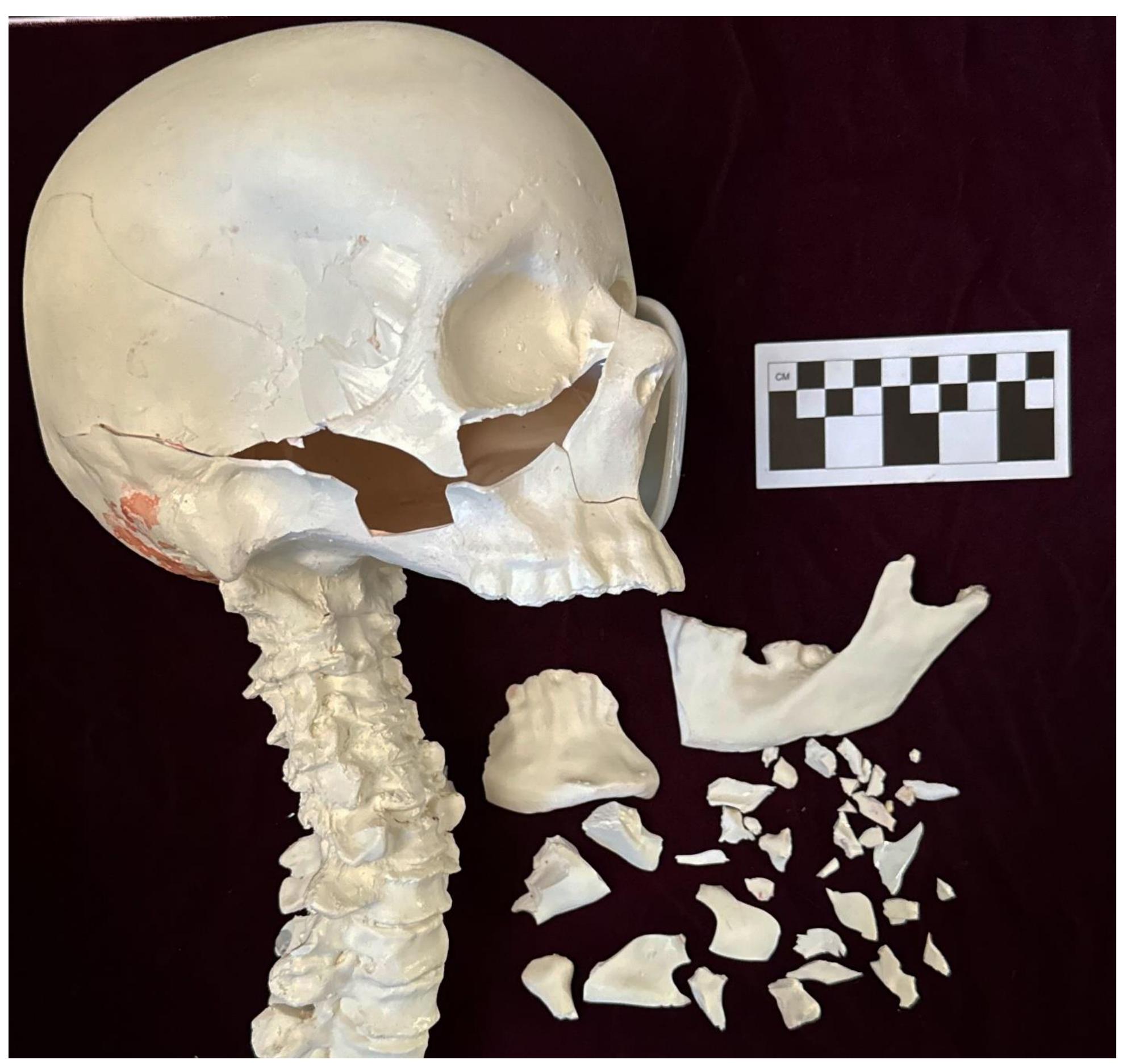Figure 53. The synthetic skull and bone fragments removed from the gelatin bust. 