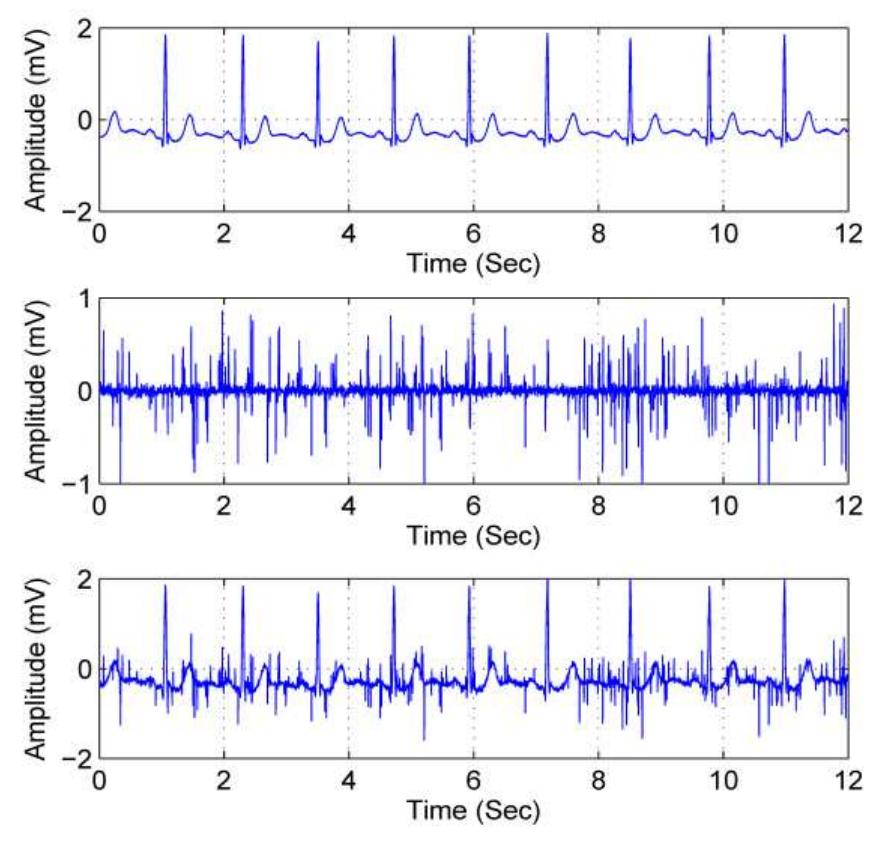 Figure 3 - from Adaptive-Filtering-Based Algorithm for