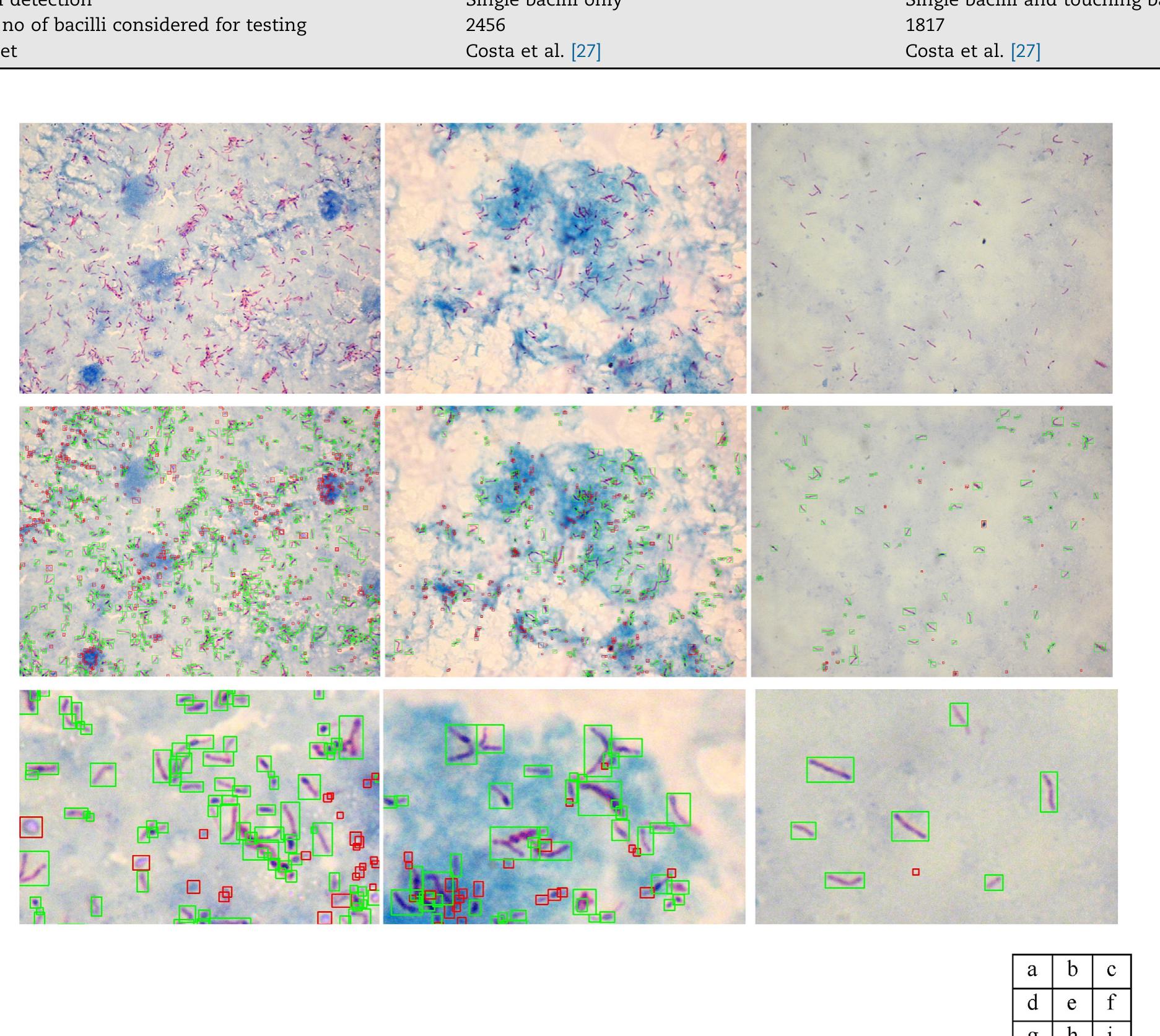 (PDF) Automatic Detection of Tuberculosis bacilli from Conventional ...