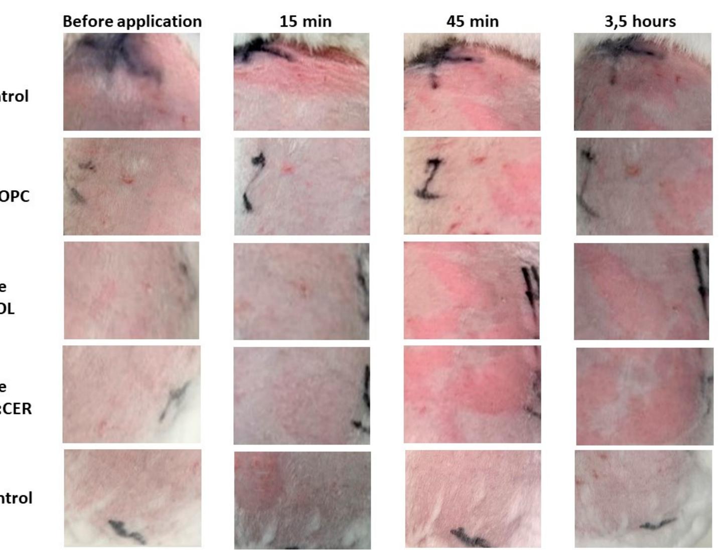 (PDF) Baricitinib Lipid-Based Nanosystems as a Topical Alternative for ...