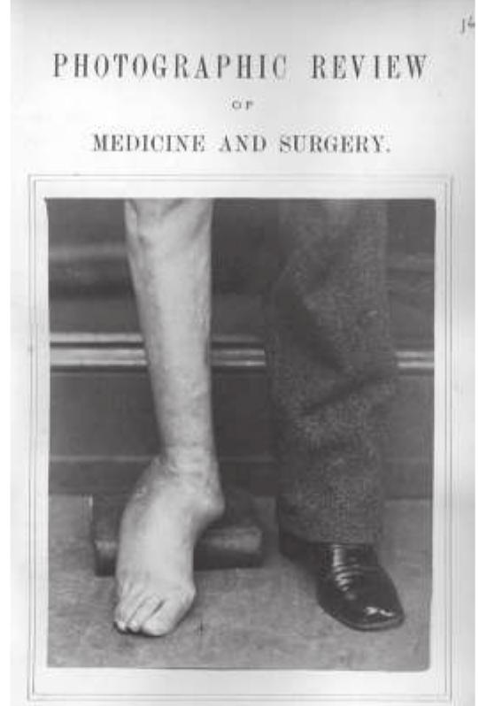 tographic Review of Medicine and Surgery in 1870, which would present a photograph and a clinical explanation of the case in each issue (figure 3.3). Montméja started the Revue Medico-Photographique along the same lines in the 1880s, and Ludwig Jankau founded the Internationale Medizinisch- Photographische Monatsschrift in 1894. The kinds of photographs we find in these pages include case documentation, diagnostic aids, and testimo- nials of intervention outcomes, all testifying to what André Gunthert has called photography’s “heuristic function.” ** We should also remark on the rise of technical books on the subject, such as Albert Londe’s La photogra- phie médicale,” and, of course, the photographic atlas.**  These photographs of medical cases usually became part of a disciplin- 