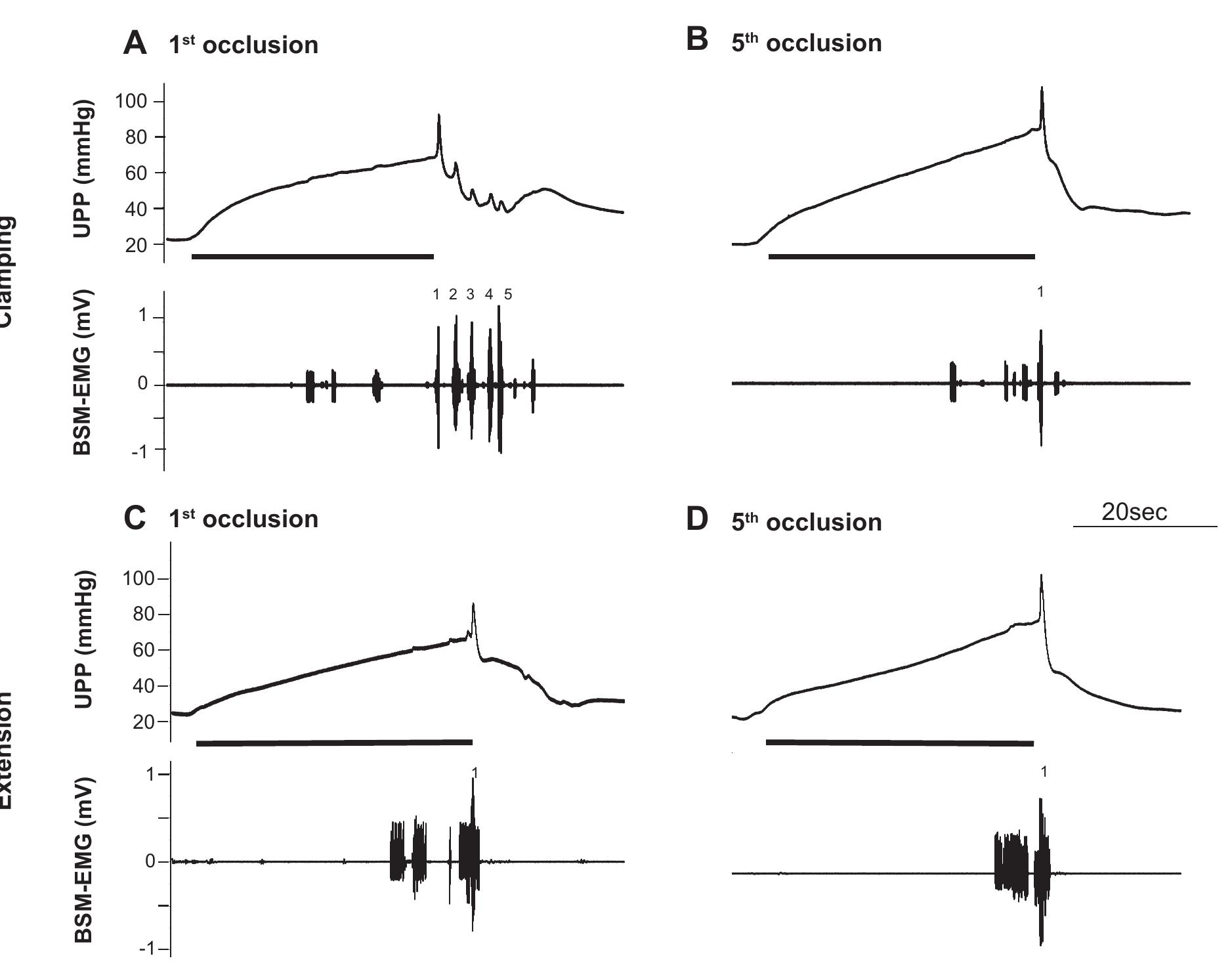 Ubs Pattern Figure 3 - from Characterization of bulbospongiosus muscle