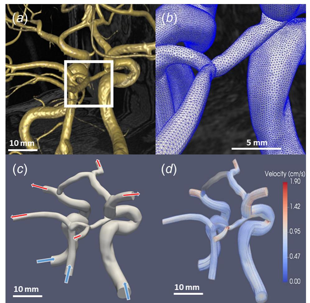 Figure 6 - from Computational Fluid Dynamics of Vascular