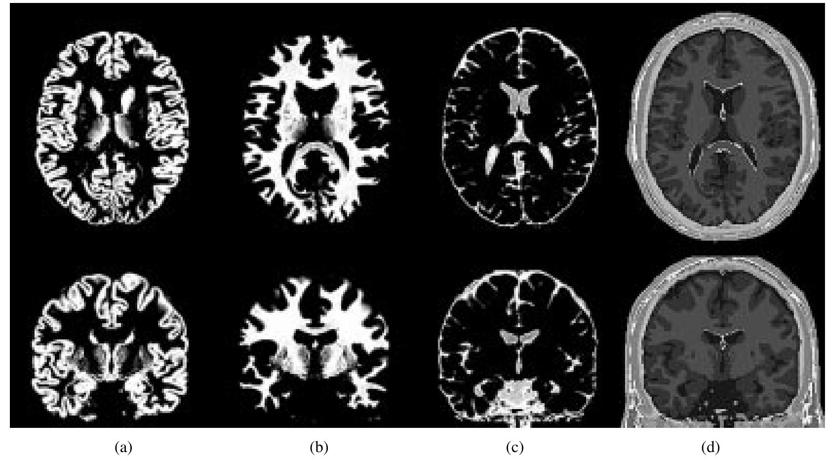 (PDF) Design and construction of a realistic digital brain phantom