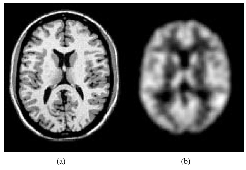 (PDF) Design and construction of a realistic digital brain phantom