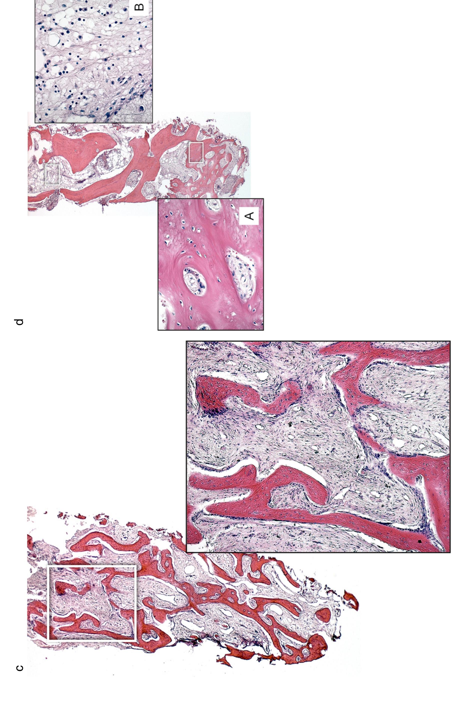 (PDF) Wound healing of extraction sockets