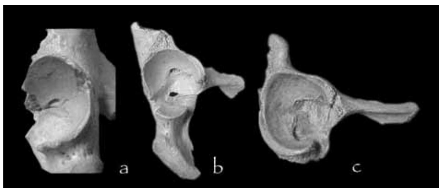 (PDF) Musculoskeletal Stress and Adult Age Markers in the Krapina ...