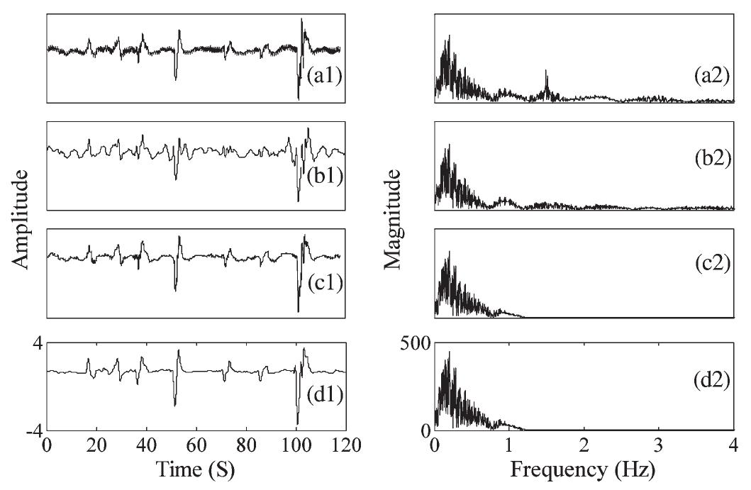 (PDF) A Novel Approach for Motion Artifact Reduction in PPG Signals ...