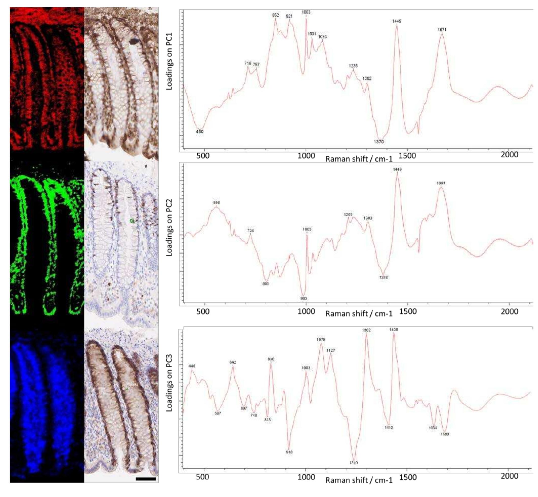 Figure 3 - Developing Raman spectroscopy as a diagnostic
