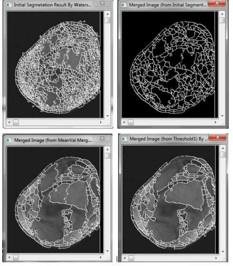 (PDF) Medical Image Segmentation Based on Edge Detection Techniques