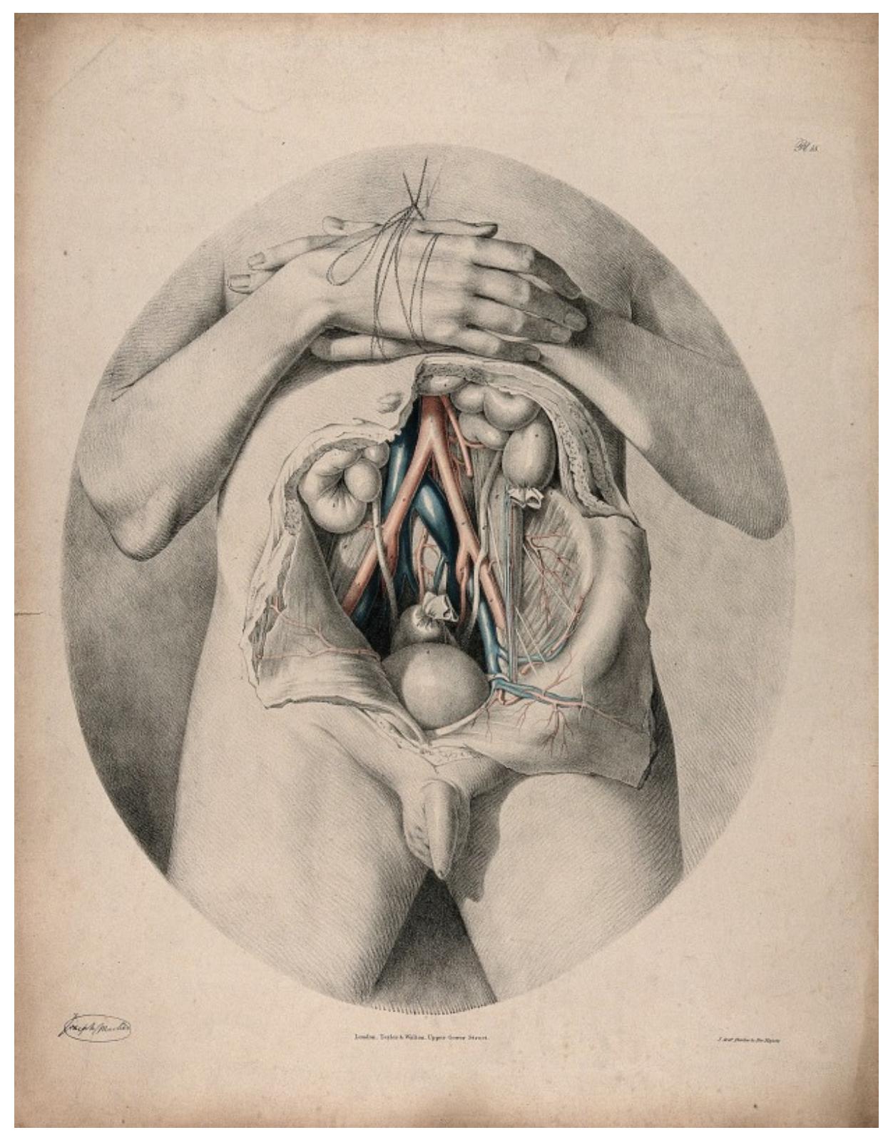 Figure 24 - Bloodlines: Circulating the Male Body Across