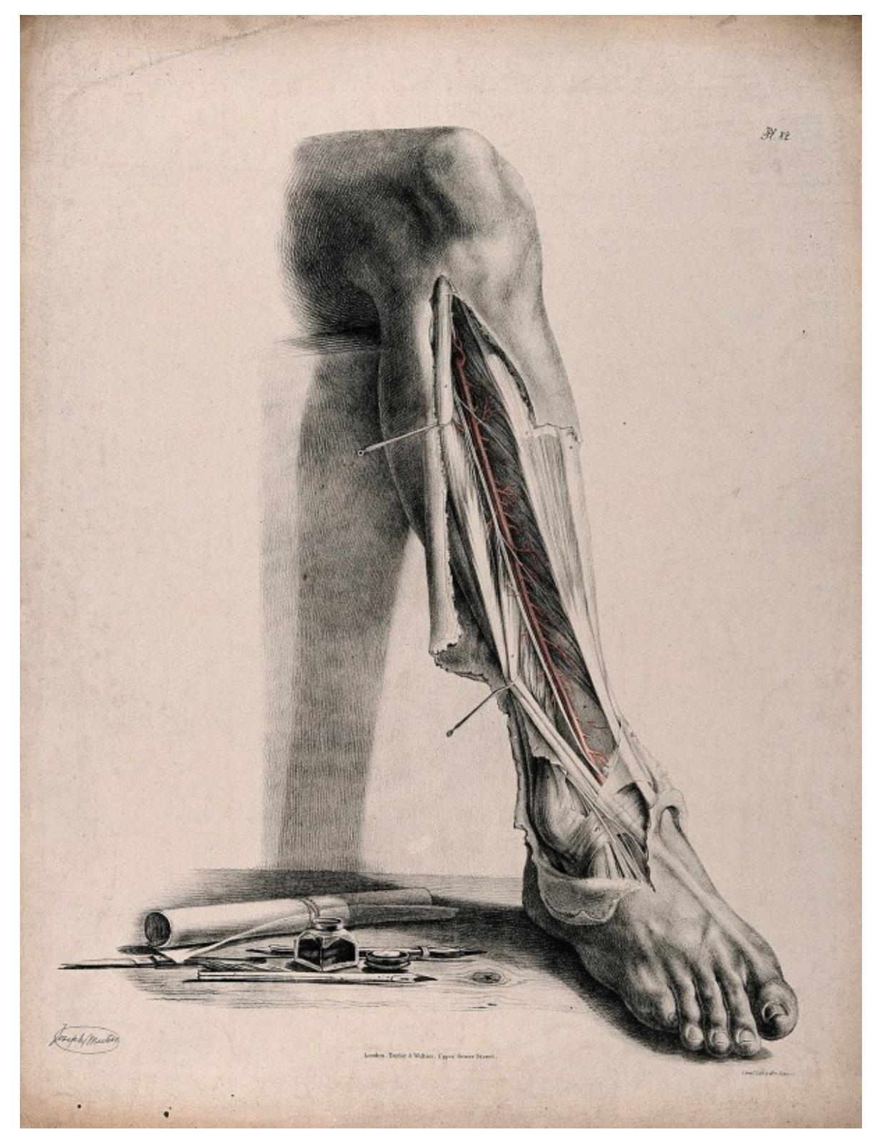 Figure 31 - Bloodlines: Circulating the Male Body Across