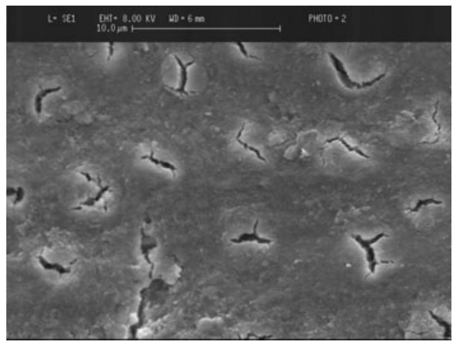 Scanning electron micrograph of smeared surface of dentine.