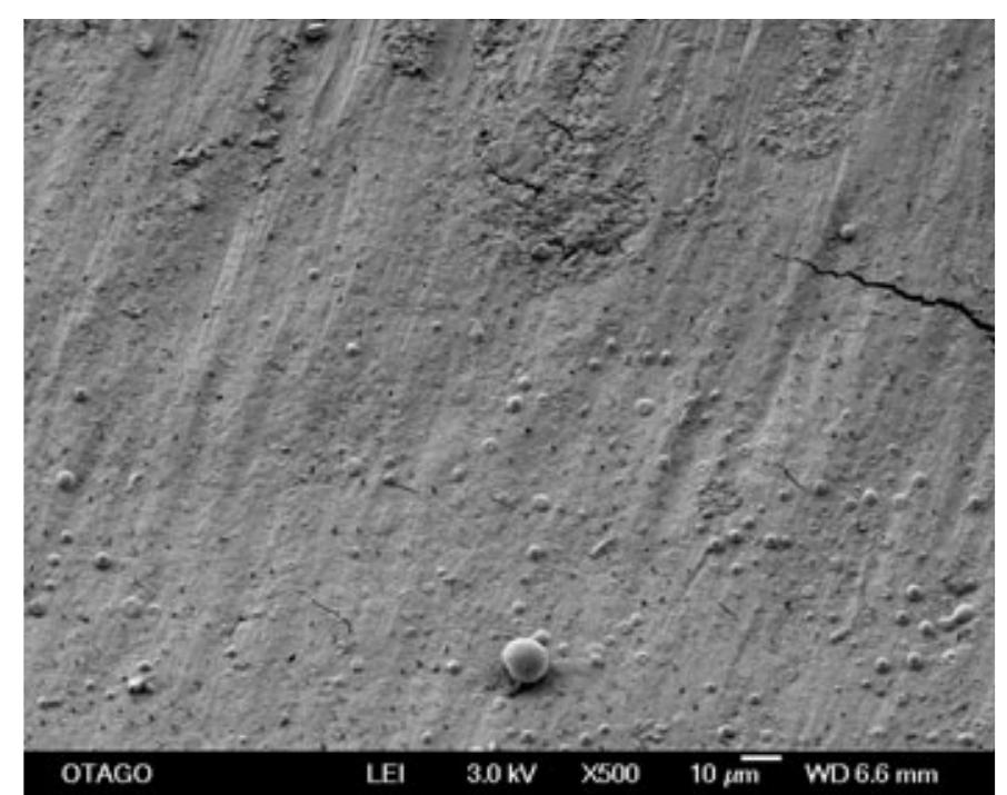 Scanning electron micrograph of dentine surface with typical