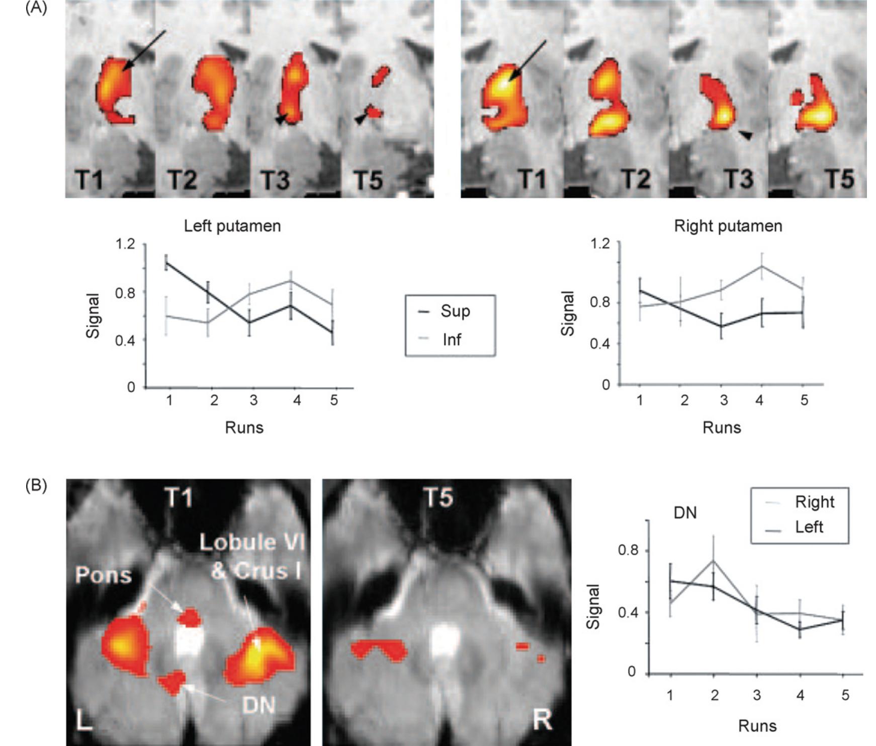 (PDF) Contributions of the basal ganglia and functionally related brain ...