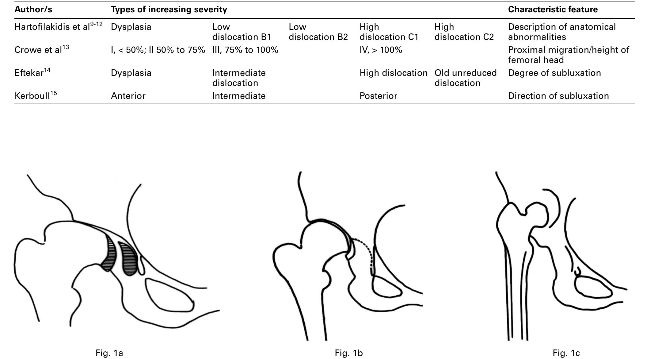 (PDF) Congenital hip disease in adults