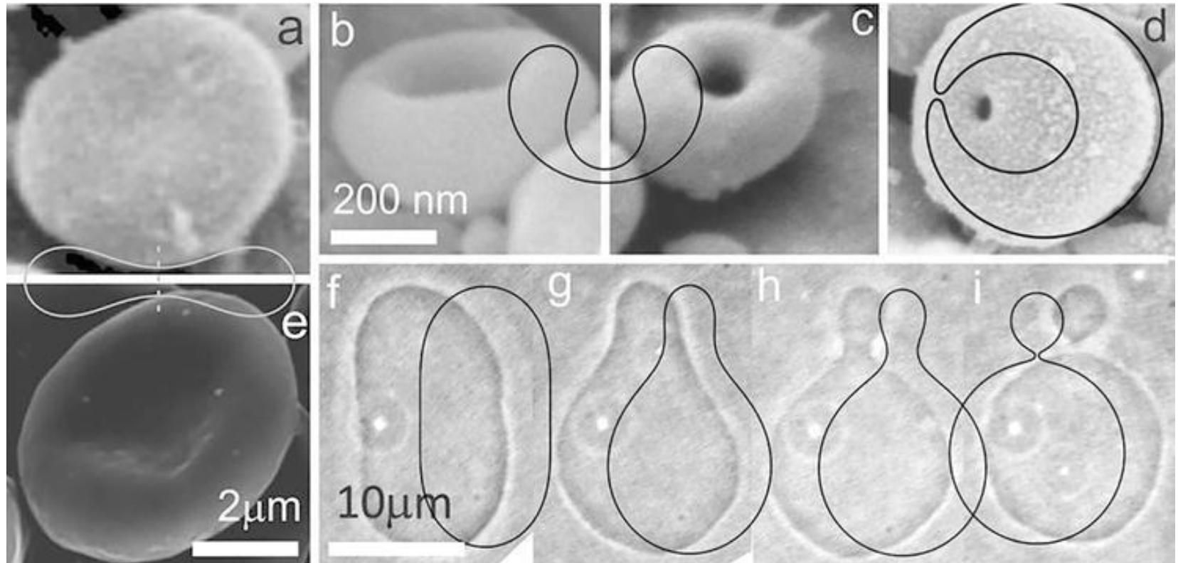 Observed and calculated membrane shapes corresponding to a