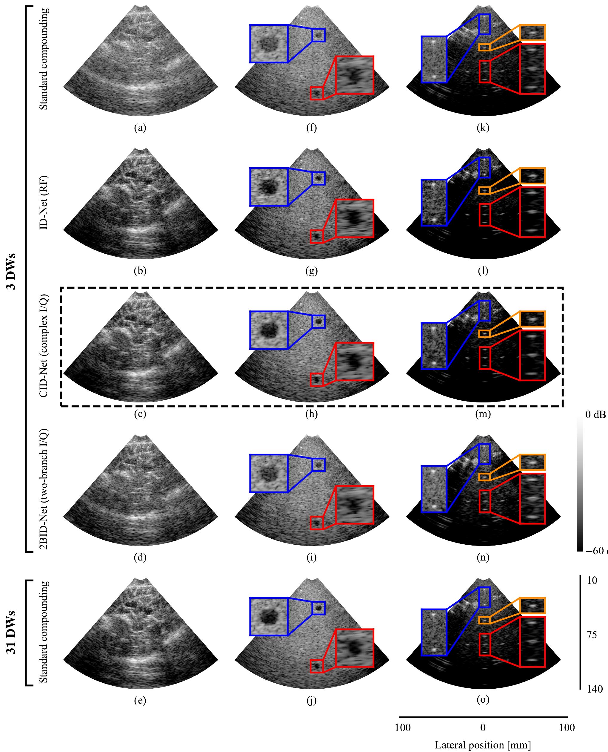 Figure 4 - Complex Convolutional Neural Networks for