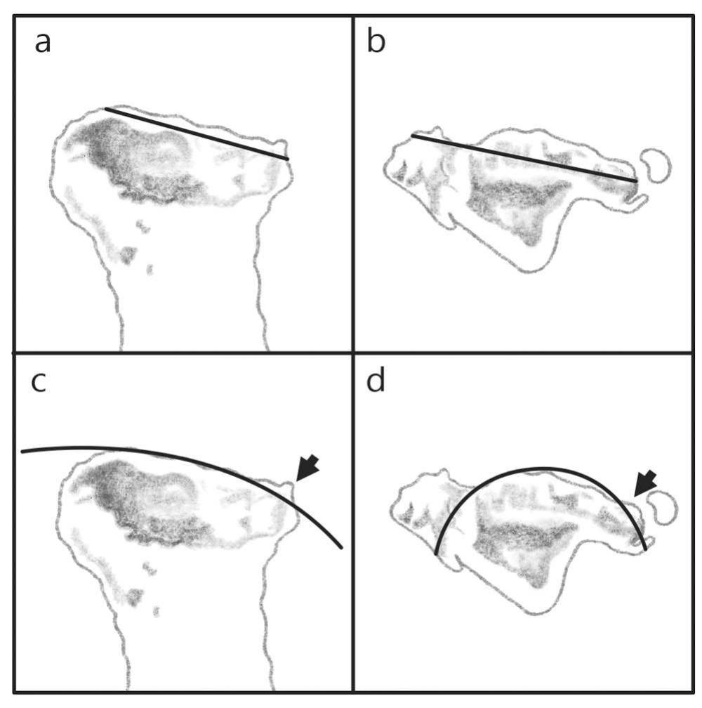 Method of tibial plateau assessment on computed tomo-