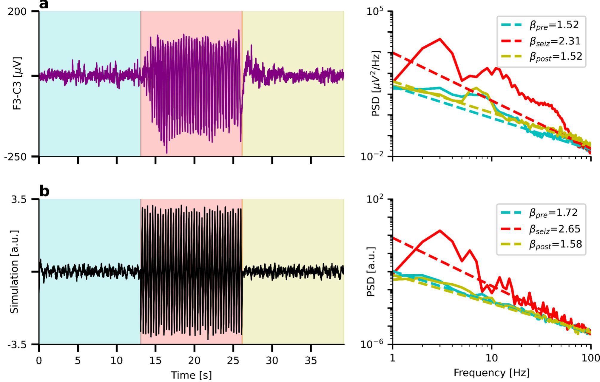 (PDF) Separating Neural Oscillations from Aperiodic 1/f Activity ...